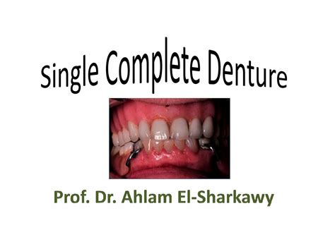 1- Maxillary single denture opposing natural teeth