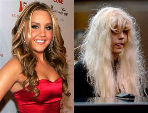 7 impactantes fotos de celebridades con su antes y después de las