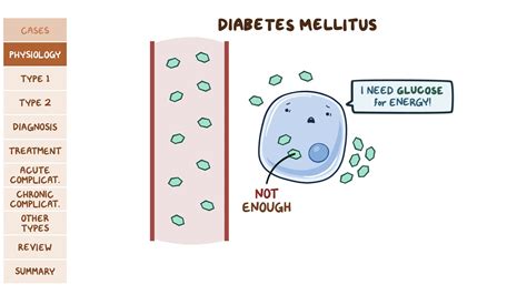 Diabetes Mellitus Pathology Review Video And Anatomy Osmosis