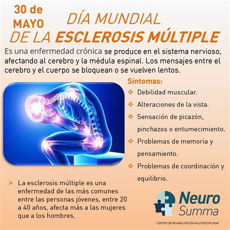 Esclerosis MÚltiple ¿qué Es Y Cómo Se Trata