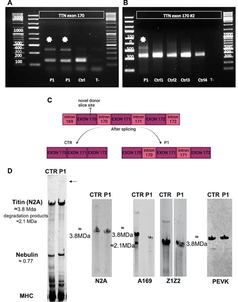 Rna And Protein Studies A B Rt Pcr Agarose Gel Electrophoresis Using