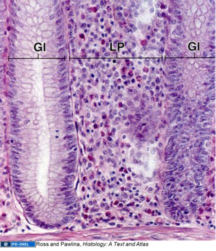 Histo Path Lecture 11 Histology Of The Lymphatic System Flashcards