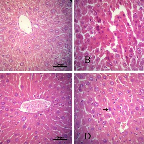 Photomicrographs Of Liver Sections Stained With Hematoxylin And Eosin