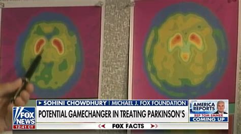 First Parkinson S Drug To Slow Or Reverse Disease Progression Looks Promising Fox News