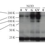 Stat Binding To Chromatin Increases After Gm Csf Stimulation In Nod