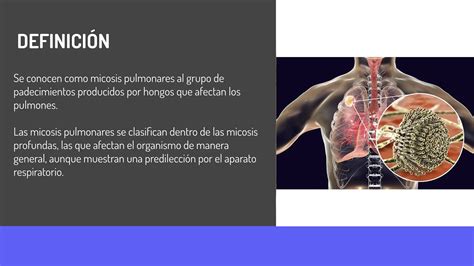 Micosis Pulmonares De Enfermedades Pulmonares Ppt Descarga Gratuita