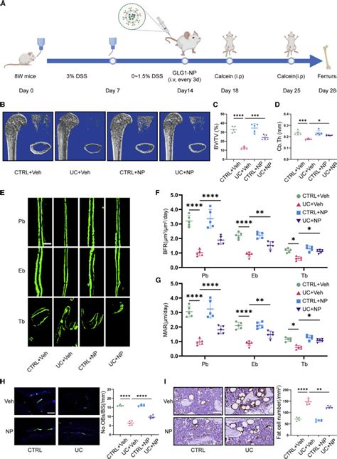 Exosome Based Bone Targeting Drug Delivery Alleviates Impaired