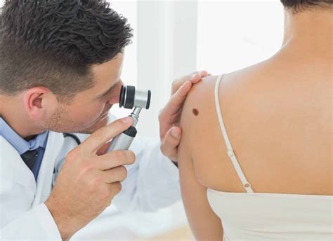 Malignant Melanoma St Michaels Clinic