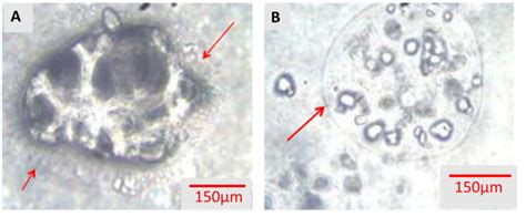 Light Microscopic Morphology Of Microbead Encapsulation Of