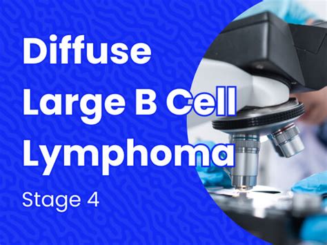 Diffuse Large B Cell Lymphoma Stage Massive Bio