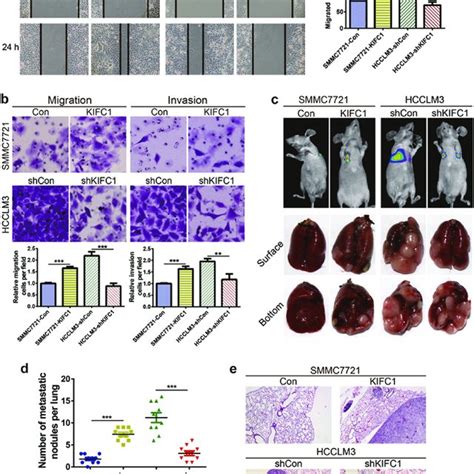 Kifc Promotes Hcc Cell Migration And Invasion In Vitro And Lung