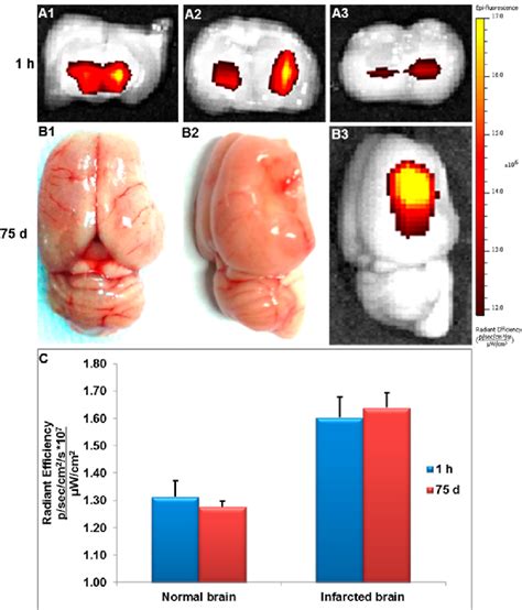 Ex Vivo Ivis Imaging And Quantitative Analysis Of The Stroked Brain In