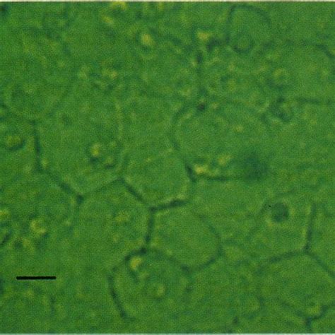 Interleukin-l concentration in human lens epithelial cell culture media | Download Table