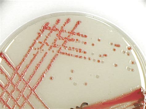 Serratia Marcescens Colony Morphology