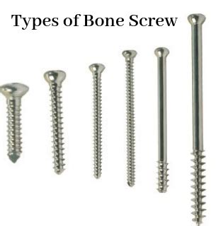 Types of Orthopaedic Bone Screws Used in Surgeries - CONSOPHARMA+