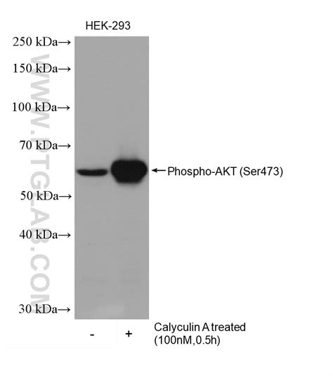 Phospho Akt Ser Antibody Hrp Proteintech