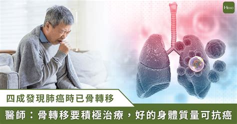 連續 42 年奪走最多國人性命！4 成肺癌發現時已骨轉移 3 方法積極治療重拾生活品質 醫藥健康 生活 Nownews今日新聞