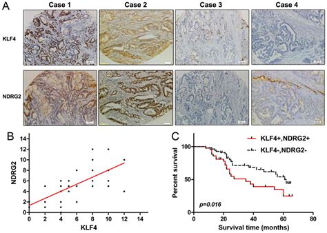 Klf Inhibits Colorectal Cancer Cell Proliferation Dependent On Ndrg