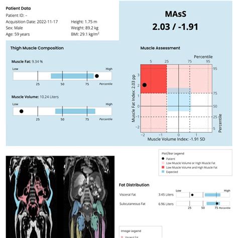 An Example Of Clinical Report For Body Composition Profiling AMRA