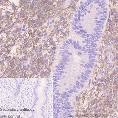 Recombinant Anti Pdgfr Alpha Antibody Epr Bsa And Azide