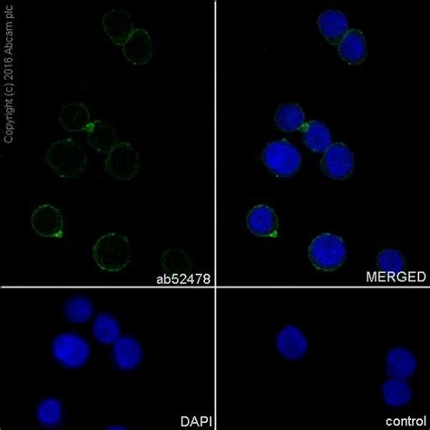 Macrophage Marker (CD11b, CD68, CD163, CD14, CD16) Antibody Panel - Human (ab254013)