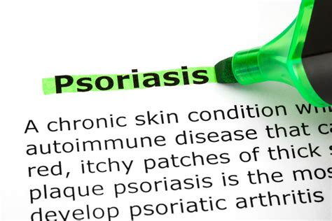 Pediatric Psoriasis Treatment Guidelines Unveiled – Trusted Health Products