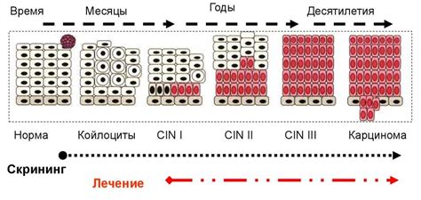 Интерферон При Впч – Telegraph