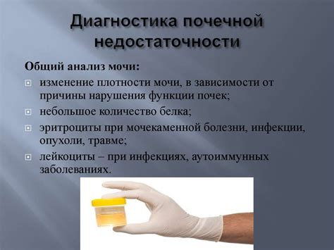 Острая почечная недостаточность - презентация онлайн