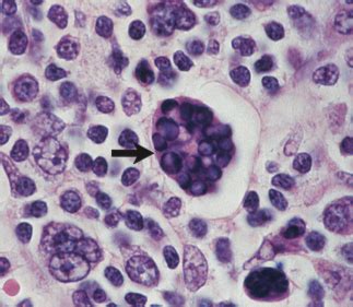 Respiratory pathogens Flashcards | Quizlet