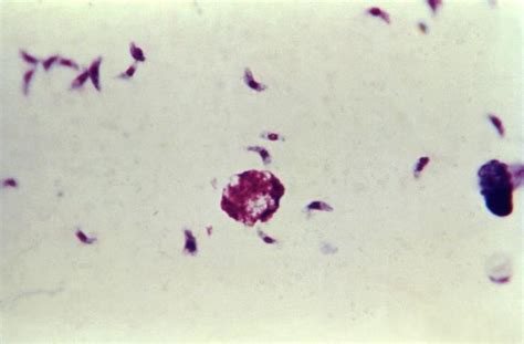 Toxoplasma Gondii Parásito Agentes Biológicos