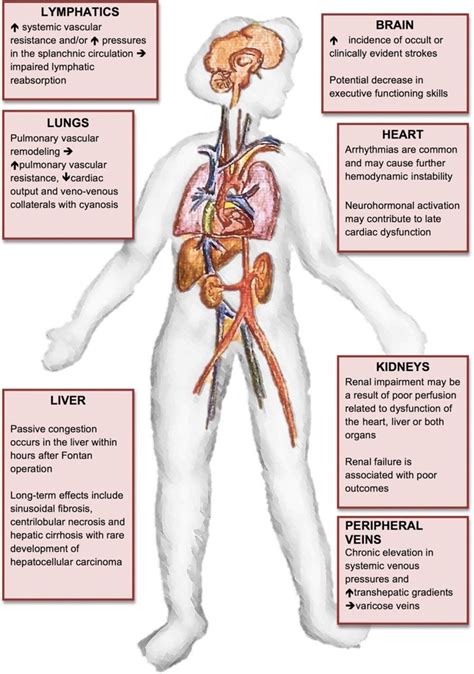 Heartbeat Time For Action To Eliminate Sex Disparities In Management And Outcomes Of Patients