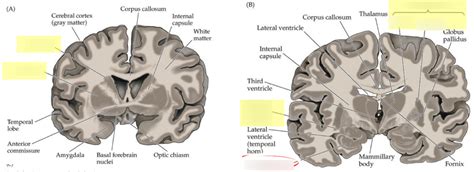 Ch. 5 Operant Conditioning - Dorsal Striatum I Diagram | Quizlet