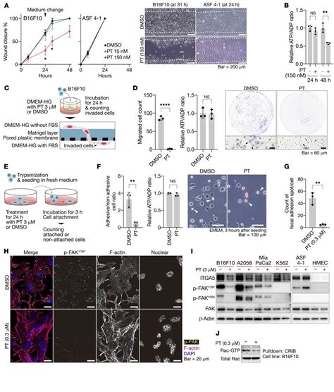 Petasin Inhibits Cellular Motility And Invasion Of Tumor Cells A