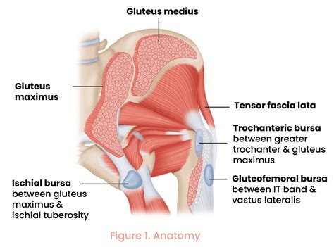 Greater Trochanteric Pain Syndrome / Gluteal Tendinopathy | Restore