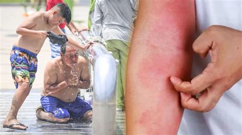 Calor En Lima Las Cinco Enfermedades A Las Que Están Expuestos Los