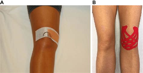 Tape Applications For Patients With Pfp Notes A Application Of A