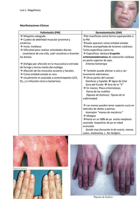 Solution Miopatias Inflamatorias Resumen Studypool