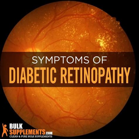 Diabetic Retinopathy: Causes, Symptoms & Treatment