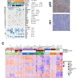 Genomic Landscape Of 44 Combined LCNECs And Gene Expression Analysis Of