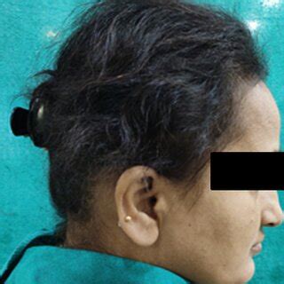 lateral view  patient  scientific diagram