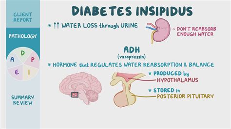 Diabetes Insipidus