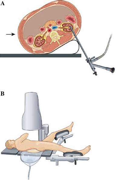 Modified Lithotomy Position 