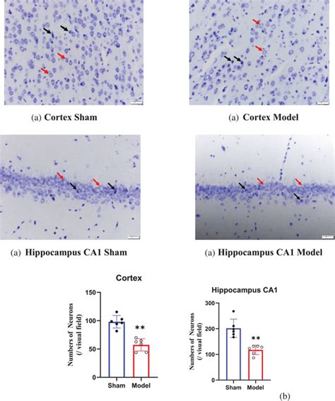 Nissl staining of the cortex and hippocampal CA1 region 0 35 mm² of