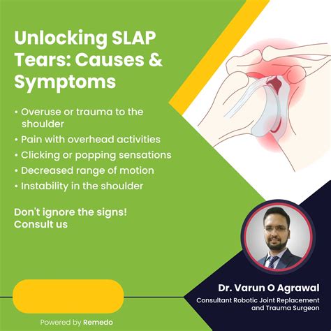 Dr - A SLAP (Superior Labrum Anterior to Posterior) tear involves