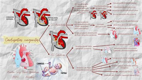 Cardiopatías Congénitas Thania Morales Udocz