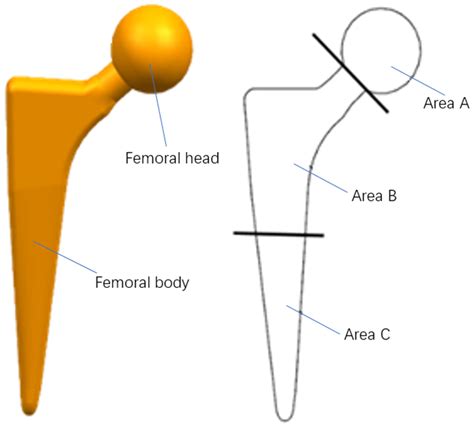 Structure Of Femoral Stem Download Scientific Diagram