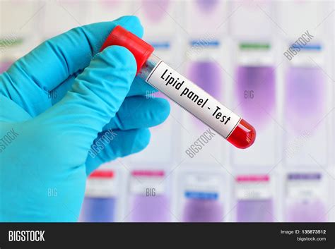 Test Tube Blood Sample Lipid Panel Image And Photo Bigstock