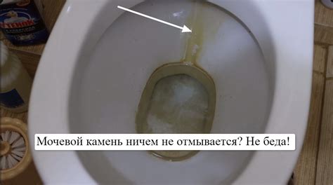 Налегке избавляемся от мочевого и окаменевшего известкового налета в ...