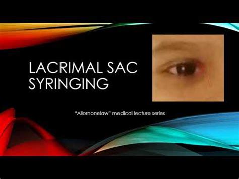 Lacrimal Sac Syringing Crystal Clear Explaination Youtube