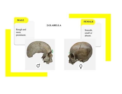 Sex Determination From Skull PPT